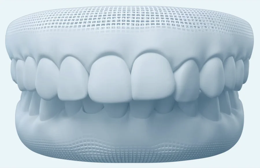Malocclusion