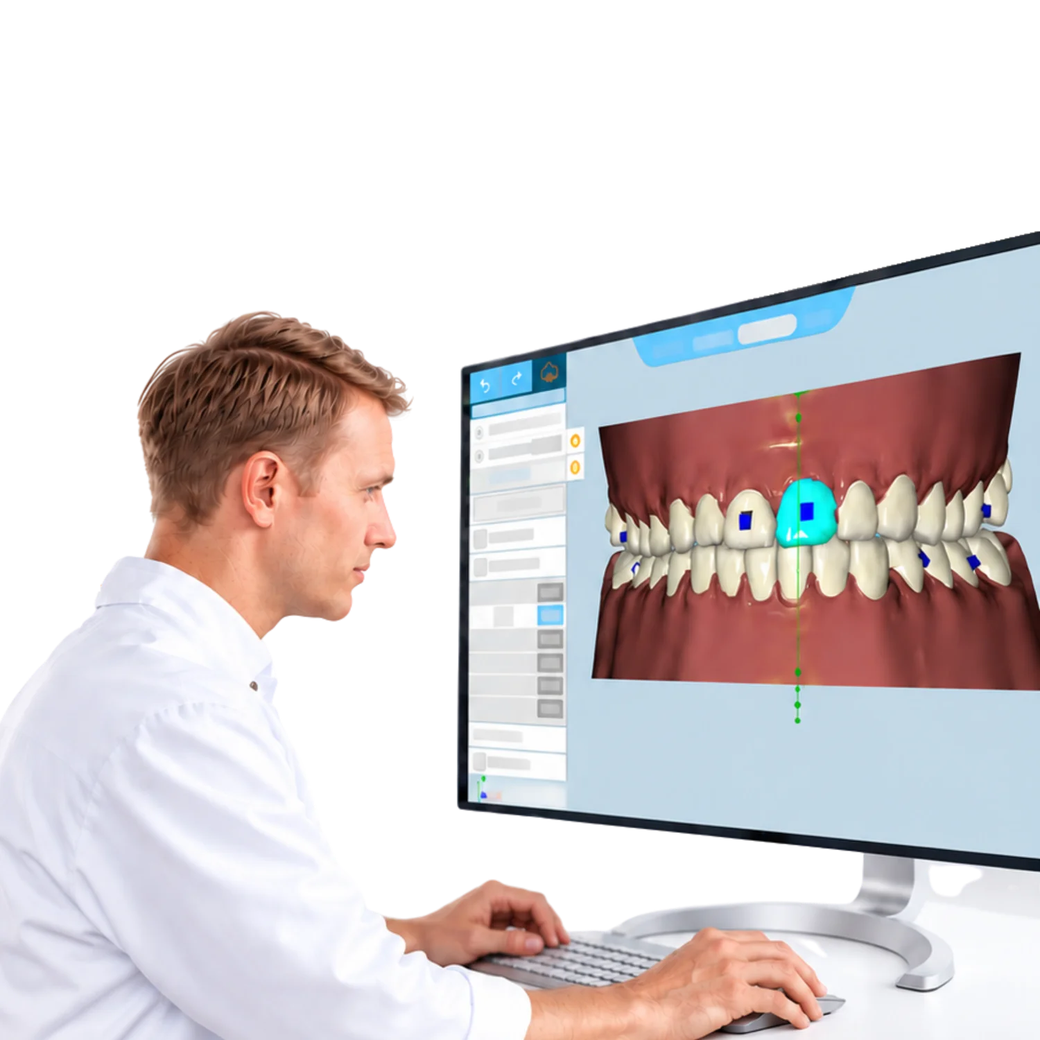 Illustration of Transparent Aligners Before and After