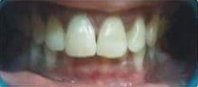 The same case after treatment