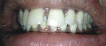 Case two before treatment