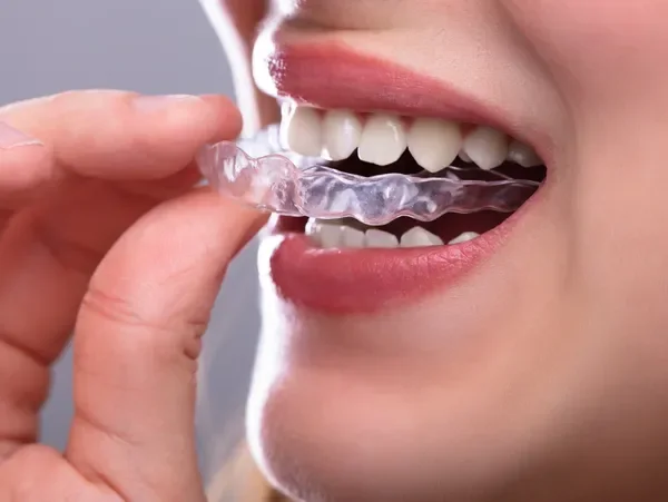 Clear aligner treatment for patients from Garden Town