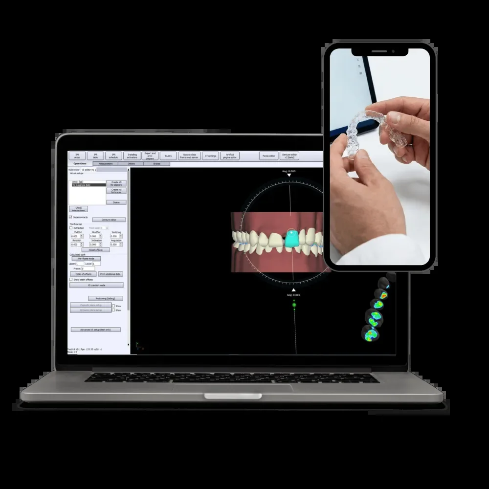 Digital 3D Smile Treatment