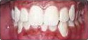 After treatment photograph for Treatment comparison 03
