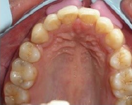 After treatment photograph for Treatment comparison 05