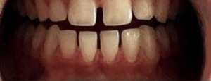 Before treatment photograph for Treatment comparison 07